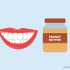 can i eat peanut butter after teeth whitening 
