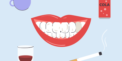 can stained teeth be whitened 