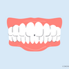 can teeth whitening cause receding gums 