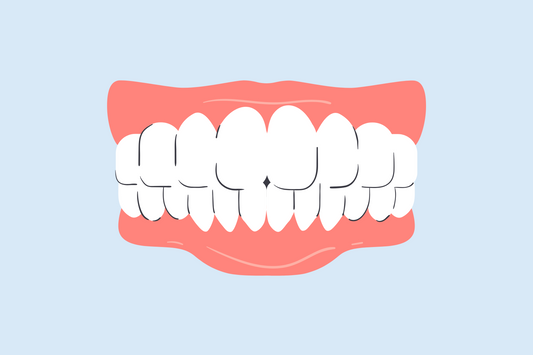 can teeth whitening cause receding gums 