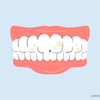 can too much whitening damage teeth 