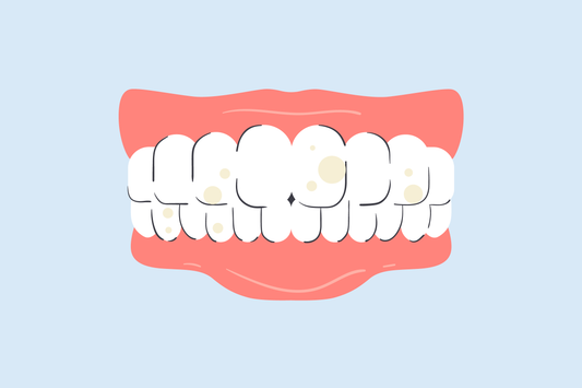 can too much whitening damage teeth 