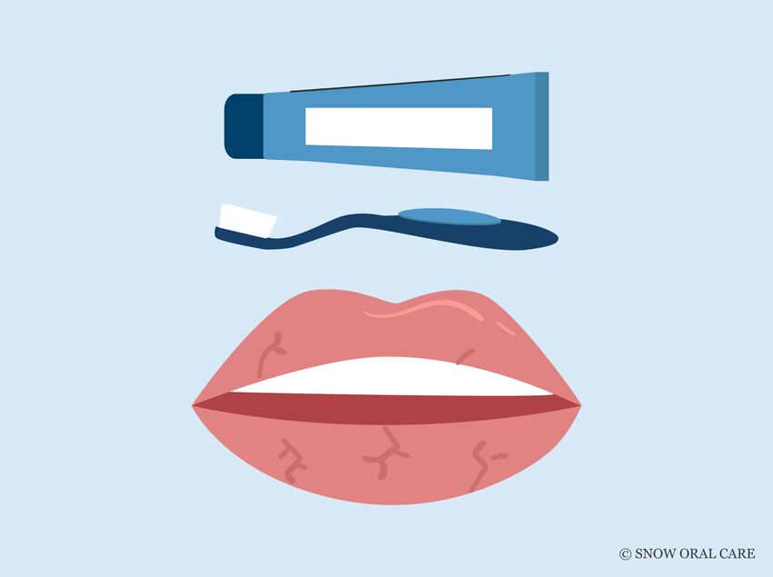 can toothpaste cause dry lips