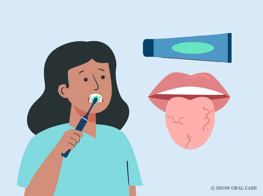 can toothpaste cause dry mouth