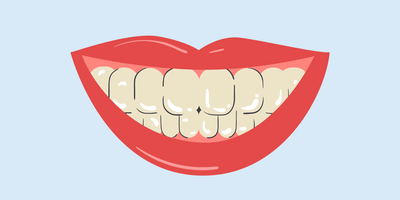 can yellow teeth become white