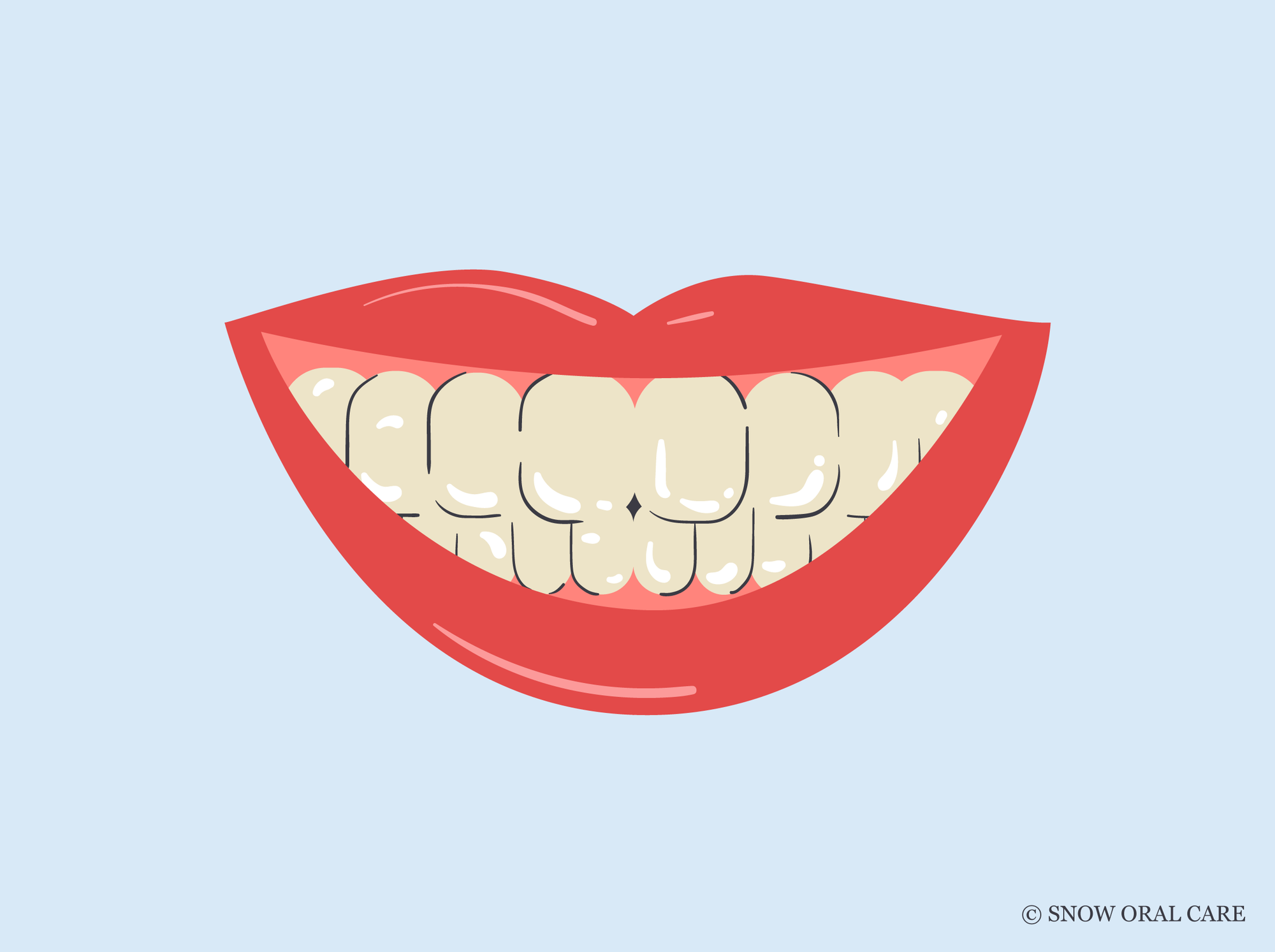 can yellow teeth become white
