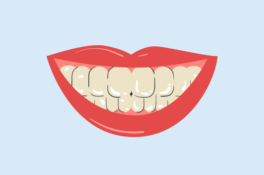 can yellow teeth become white