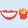 can you eat french fries after teeth whitening 