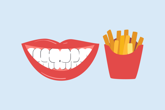 can you eat french fries after teeth whitening 