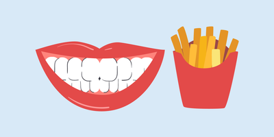 can you eat french fries after teeth whitening 
