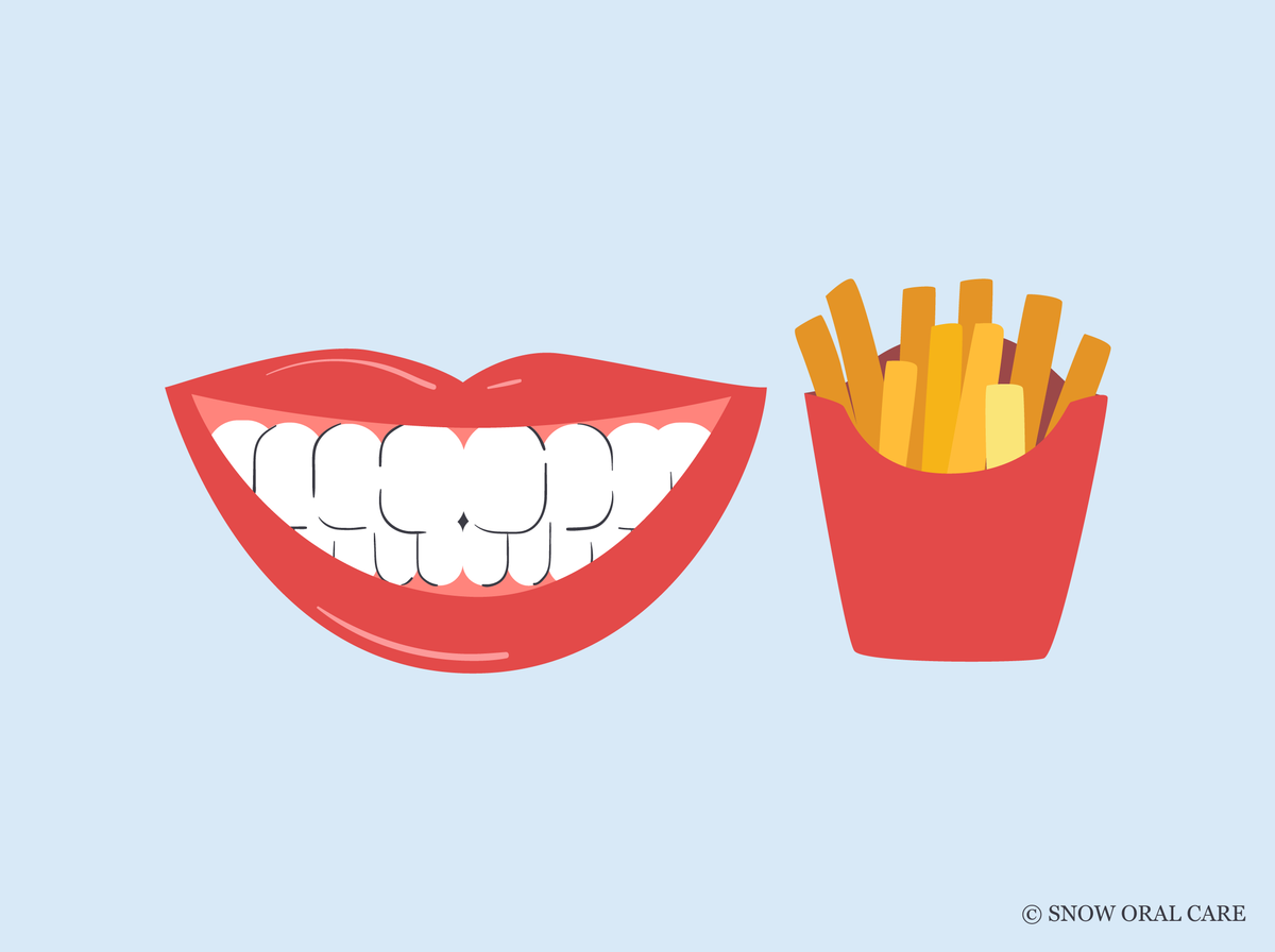 can you eat french fries after teeth whitening 