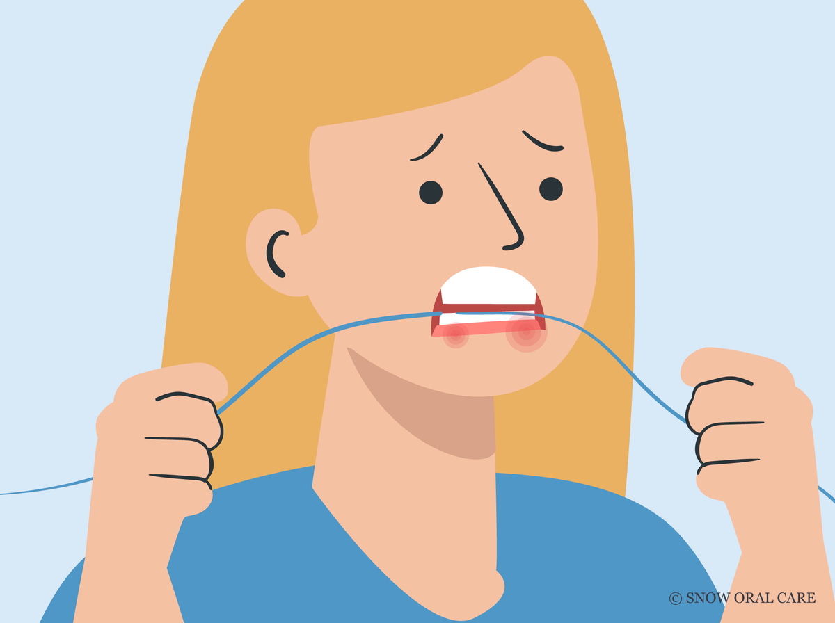 can you floss too hard