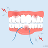 can you floss too much