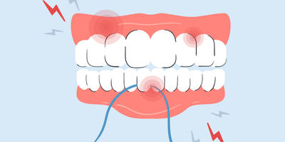 can you floss too much