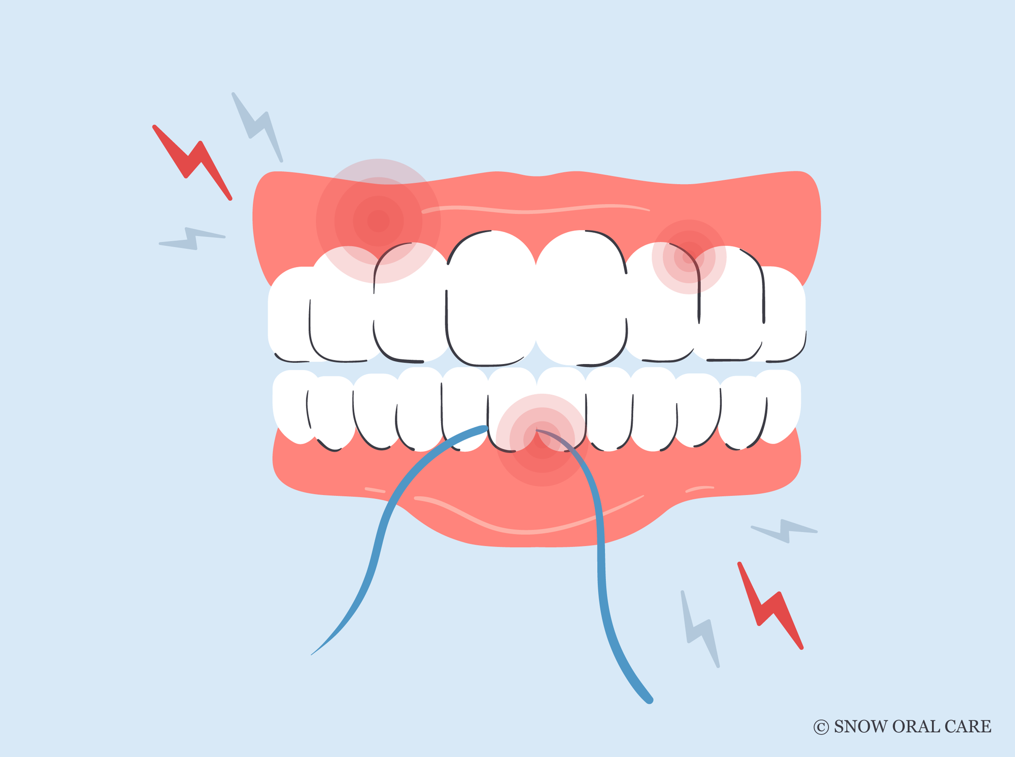 can you floss too much