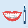 can you put teeth whitening gel in your retainer
