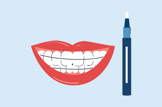 can you put teeth whitening gel in your retainer