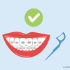 can you use floss picks with braces