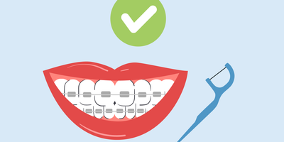 can you use floss picks with braces