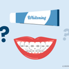 can you use whitening toothpaste with braces
