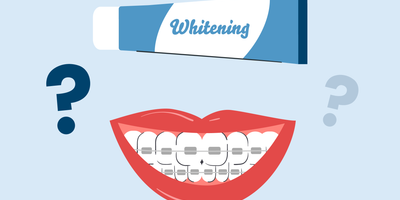 can you use whitening toothpaste with braces