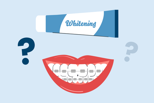 can you use whitening toothpaste with braces