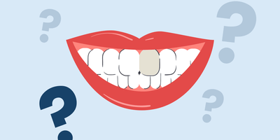 can you whiten a dead tooth 