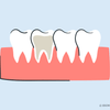 can you whiten a root canal tooth 