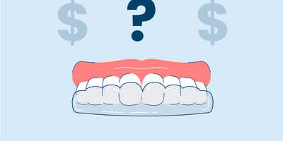 aligners
