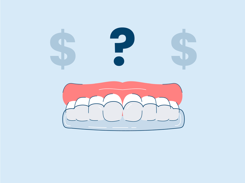 aligners