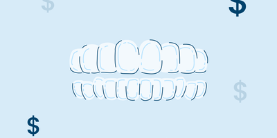 The Cost of Clear Braces in 2022