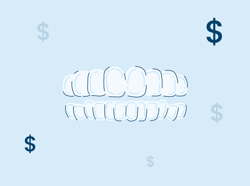 The Cost of Clear Braces in 2022
