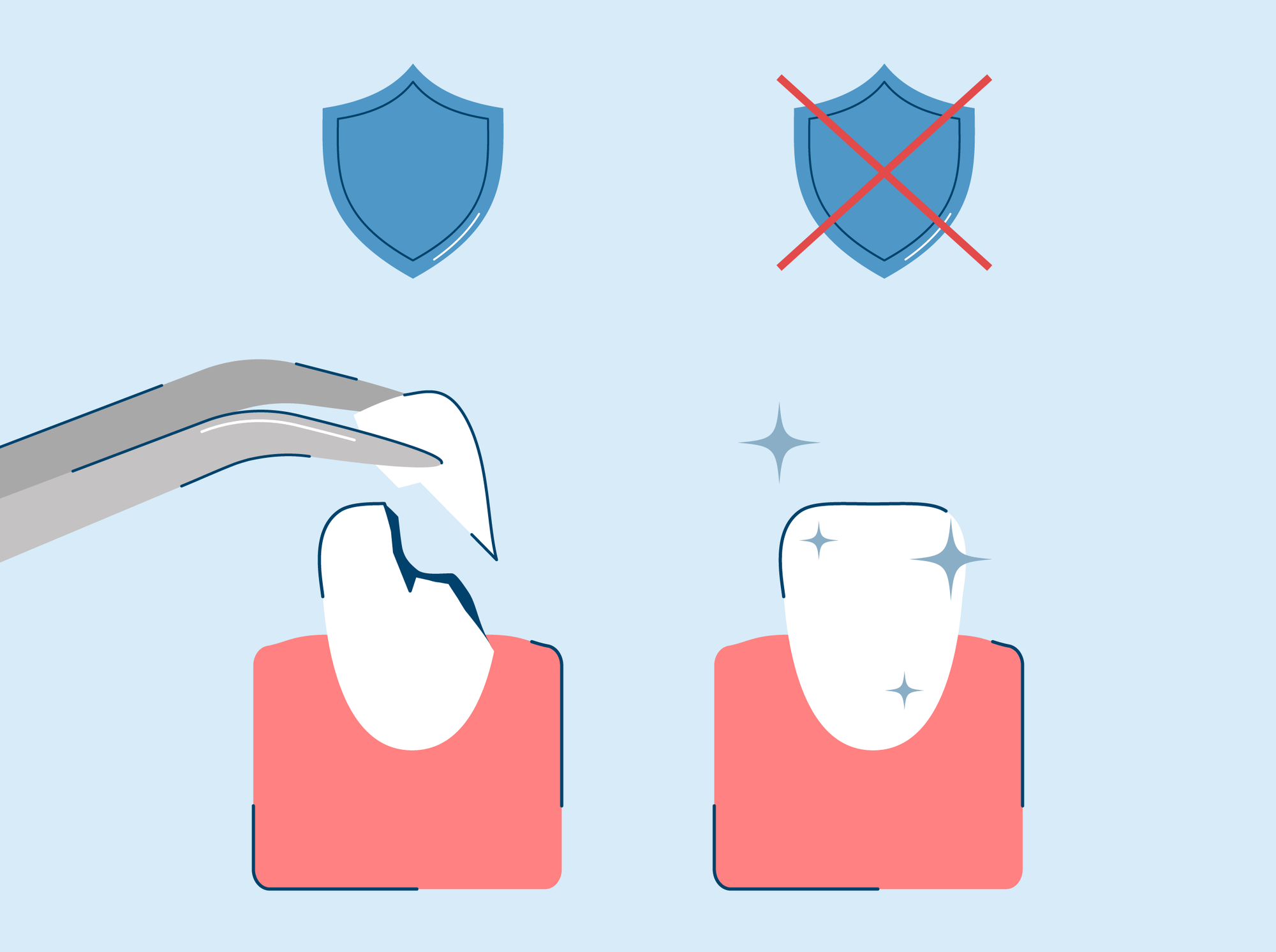 How Much Does Composite Bonding Cost?