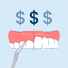 cost of laser gum surgery