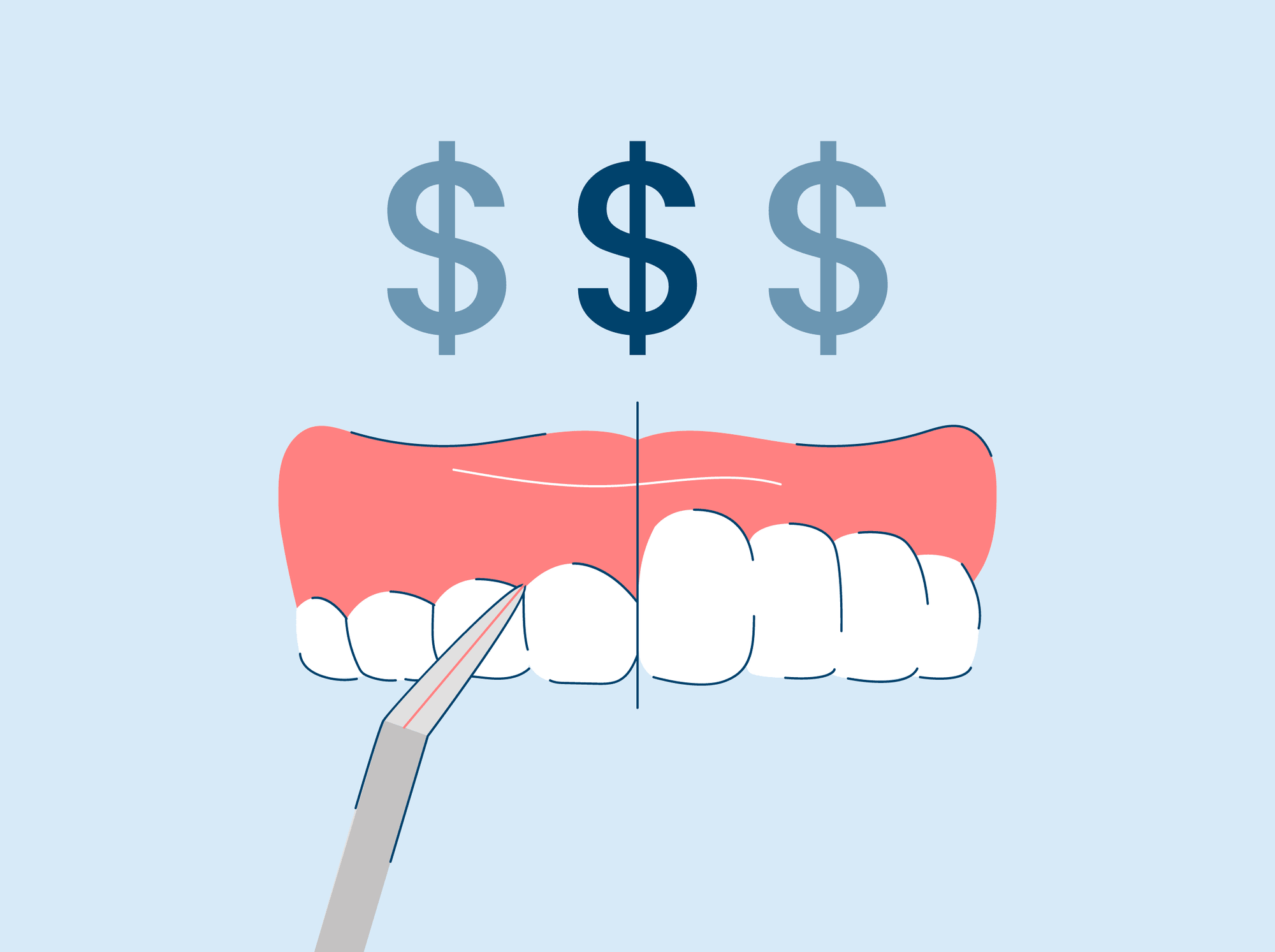 cost of laser gum surgery