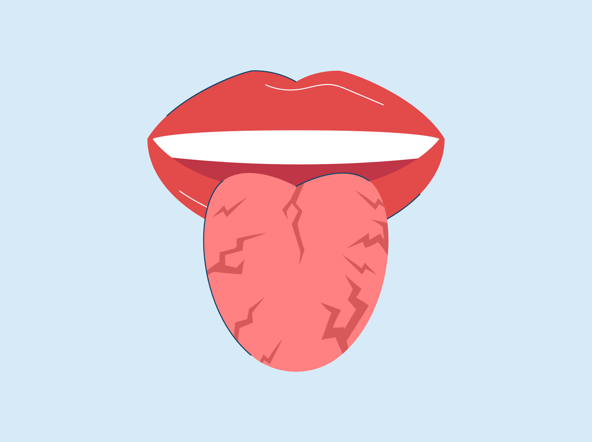 cracks in tongue