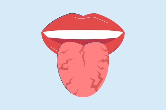cracks in tongue