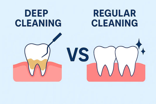 Deep Cleaning vs Regular Cleaning Teeth: What You Need to Know
