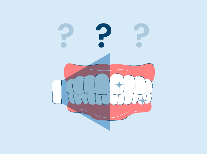 deep teeth whitening