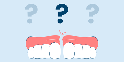 Denture Repair 101: Everything You Need to Know