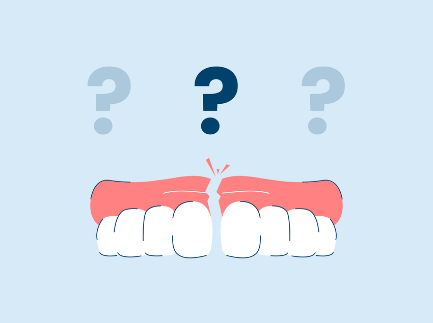 Denture Repair 101: Everything You Need to Know