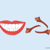  do cloves stain teeth 