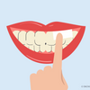 do nicotine pouches stain your teeth 