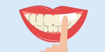 do nicotine pouches stain your teeth 
