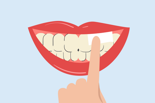 do nicotine pouches stain your teeth 