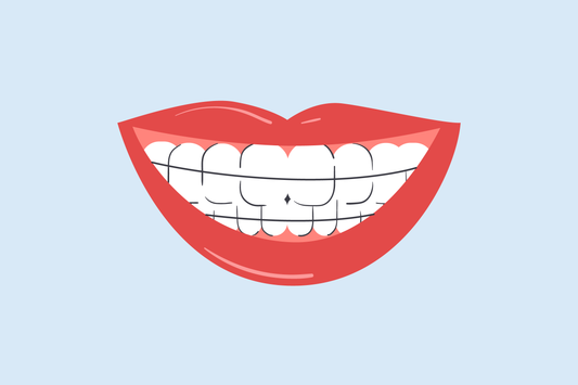do retainers make your teeth yellow 