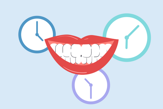 do teeth continue to whiten after treatment