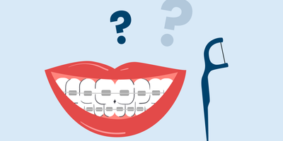 do you have to floss with braces