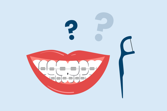 do you have to floss with braces