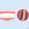 does acai stain teeth 